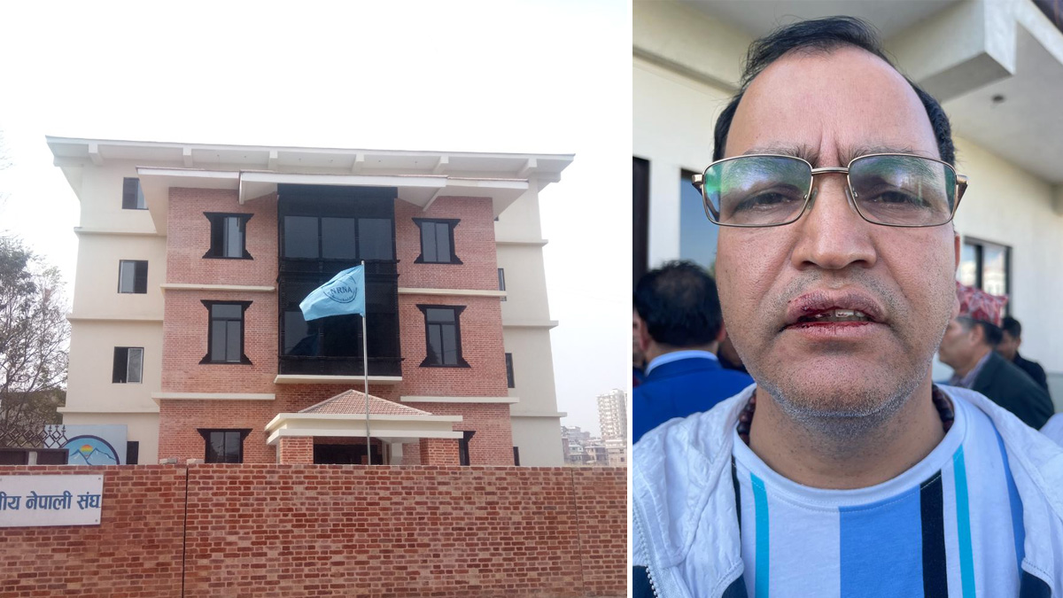 एनआरएन कार्यालयमा तनाव, फोटो खिच्न खोज्दा पत्रकार शर्मामाथि हातपात