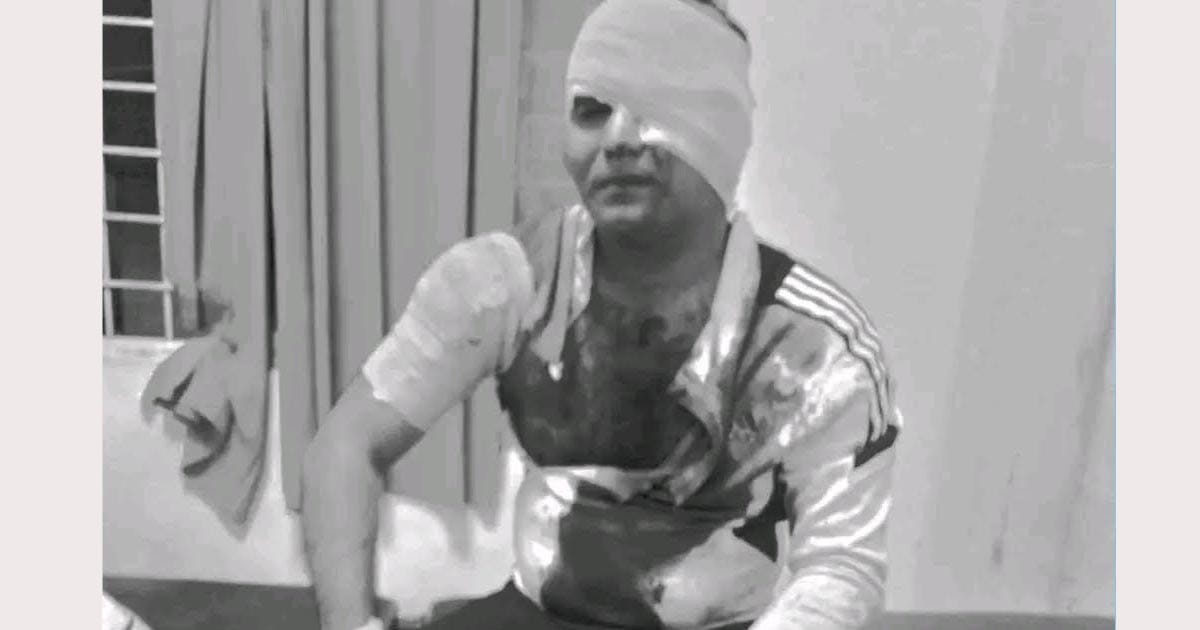 जेन जी आन्दोलनसँग संलग्न भएको आरोपमा एकजनामाथि खुकुरी प्रहार