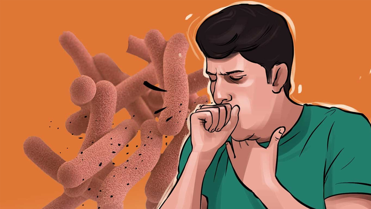 हरिवनमा १२१ क्षयरोगका नयाँ बिरामी भेटिए
