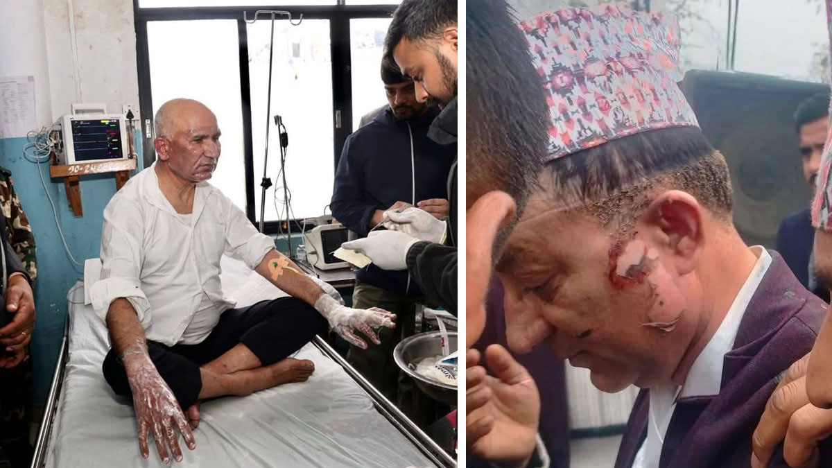 अर्थमन्त्री पौडेल र मेयर आचार्यलाई भेट्न पूर्ण रुपमा बन्द